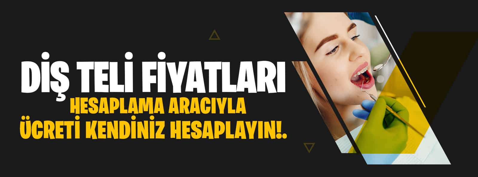 Diş teli fiyatları